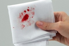 Methods of struggle: how and how can a blood stain, including an old one, be removed?